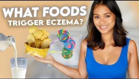 Dietary Triggers of Eczema: Foods to Avoid for Relief